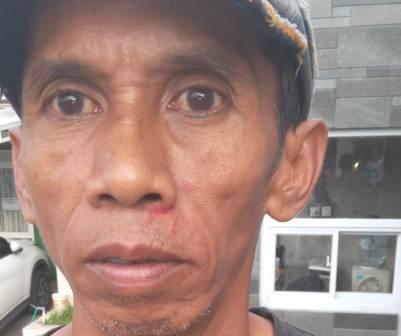 Kronologi Anggota PPPAD Dipukul Oknum Satpol PP Cianjur, Luka Memar di Wajah Masih Terasa, Pengurus Minta Jangan Emosi